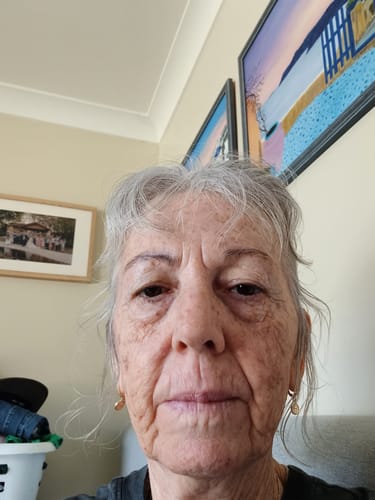 Customer photo review of SEA BUCKTHORN SERUM