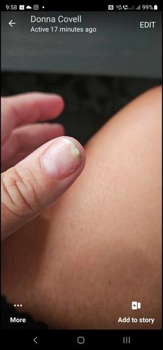 Customer photo review of Semilac Nail Power Therapy 5in1 Crystal Strong Nail Conditioner 7 ml