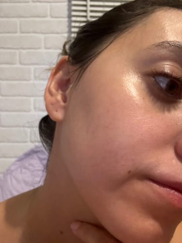 Customer photo review of Solução Niacinamida