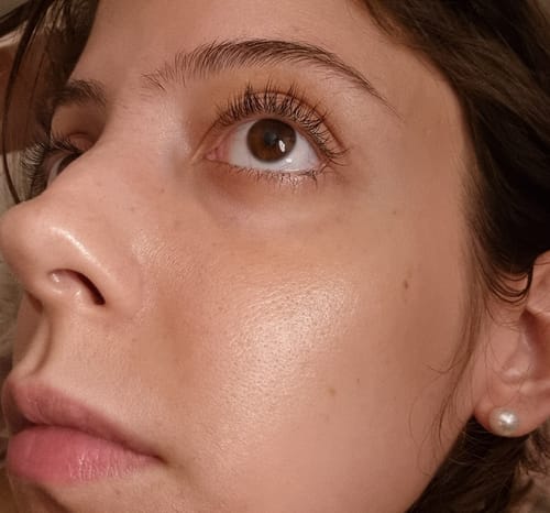 Customer photo review of Solução Niacinamida