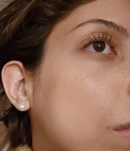 Customer photo review of Solução Niacinamida