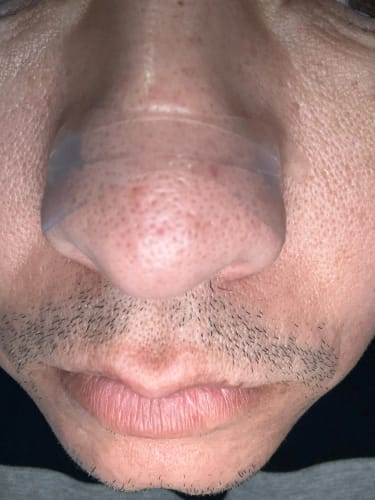 Recenzja produktu Plastry na nos GoodBreath - 50 sztuk ze zdjęciem od klienta