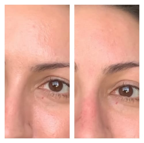 Customer photo review of Dream Roller