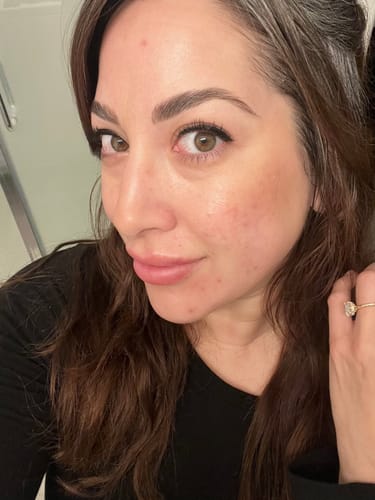 Customer photo review of Dermathod Priming Peel Booster