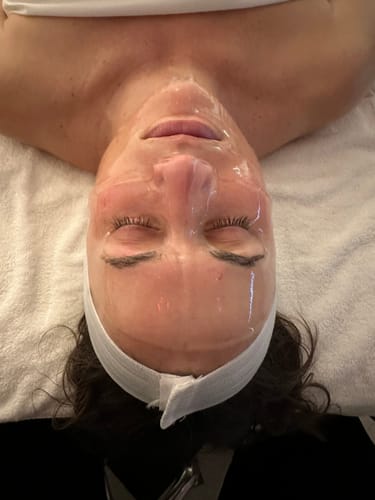 Customer photo review of The CryoPeptide 20 Pack