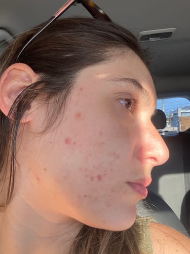 Customer photo review of Solução Retinol-Like