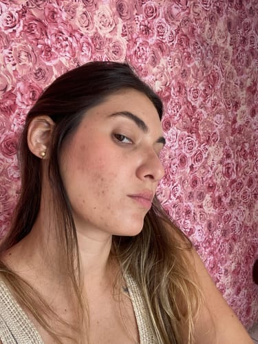 Customer photo review of Solução Retinol-Like