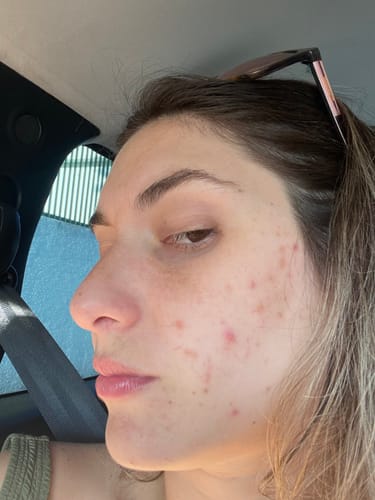 Customer photo review of Solução Retinol-Like