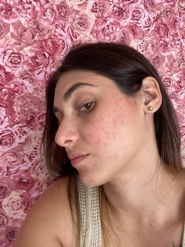 Customer photo review of Solução Retinol-Like