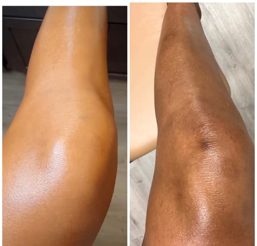 Customer photo review of Pro-Advance whitening System