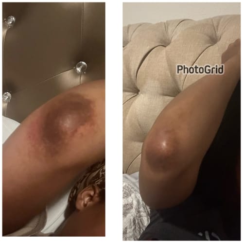 Customer photo review of Intense Discoloration Treatment (Rapid Action)