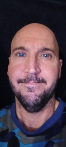 Customer photo review of Nonno Blue Contact Lenses (Prescription)