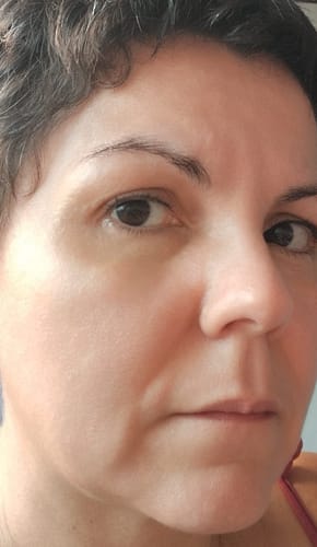 Customer photo review of Sérum Control Skin
