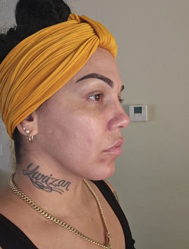 Customer photo review of Electric Blackhead Remover Vacuum