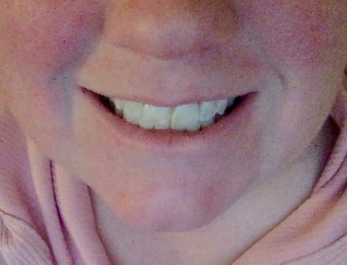 Customer photo review of InstantPurple™ Color Corrector with nHAp