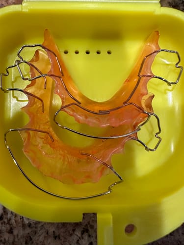 Customer photo review of Hawley Orthodontic Retainer, Buy One Get One 50% Off BOGO! Use code: HAWLEY50