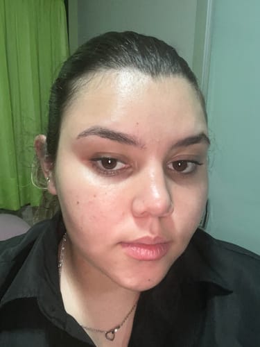 Customer photo review of Solução Niacinamida