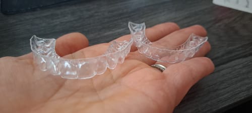 Customer photo review of Upper and Lower Retainers Set