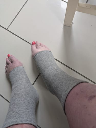 Customer photo review of Premium Bamboo Knee Sleeve (Single)