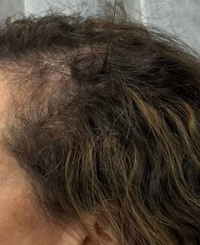 Customer photo review of The Ultimate Hair Growth Bundle