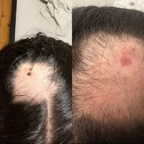 Customer photo review of The Ultimate Hair Growth Bundle