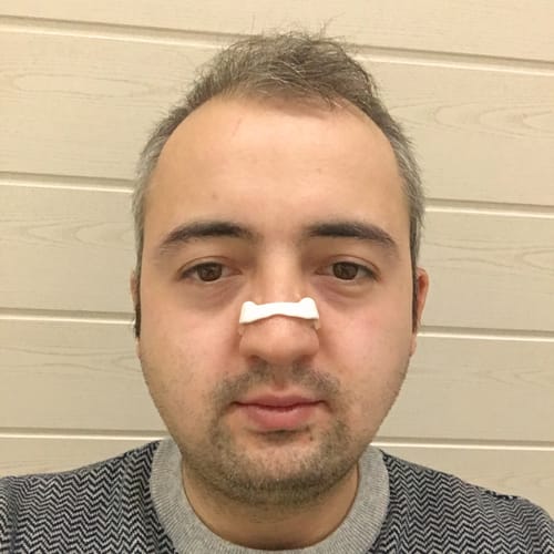 Customer photo review of AirBreathe Pro