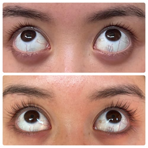 Customer photo review of LASH SERUM