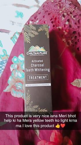 Customer photo review of Activated Charcoal Teeth 🦷 Whitening Treatment - Whitens Teeth Naturally, Kills Cavity causing Bacteria Eliminates Bad Breath