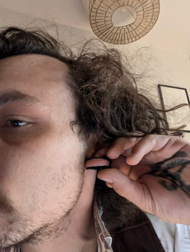 Customer photo review of Keloid Bump Shrinking Duo