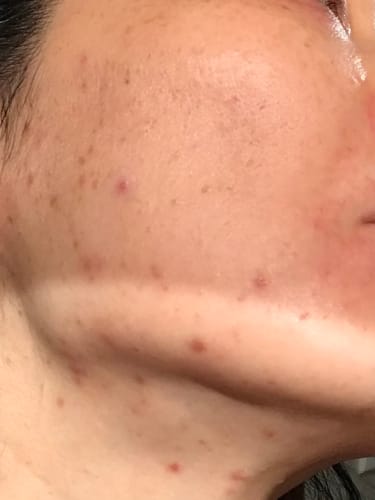 Customer photo review of (Pre-order) Radiance Powder