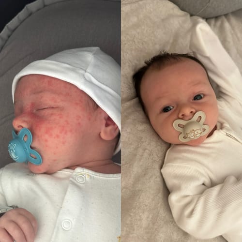 Customer photo review of Baby-Soft Balm Stick