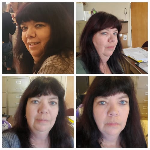 Customer photo review of Tirzepatide Weight Loss Program