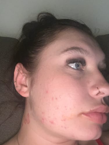 Customer photo review of Skin & Gut Maintain™