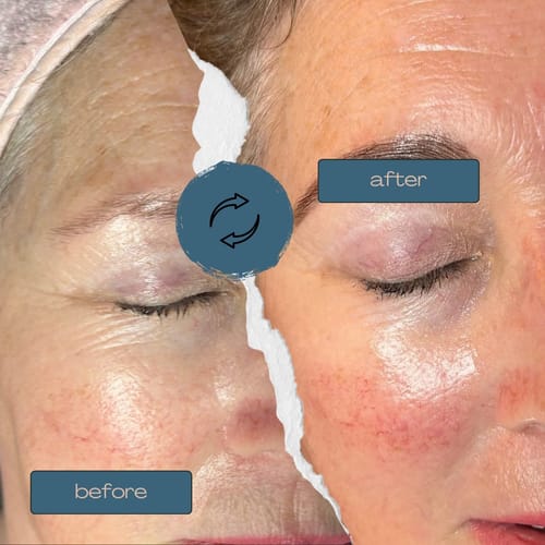 Customer photo review of Zena BX Alternative Ampoule Set