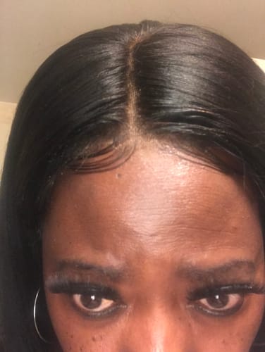 Customer photo review of Skin Protector