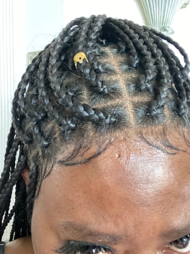 Customer photo review of Skin Protector