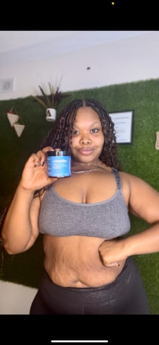 Customer photo review of Curaslim