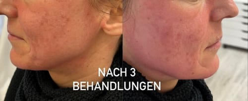 Customer photo review of SQT Revitalizing Starterset inkl. Online Schulung