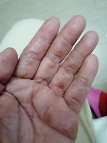Customer photo review of West-Coat Aqueous Cream 100 GM