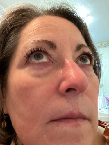 Customer photo review of EYELASH GROWTH SOLUTION