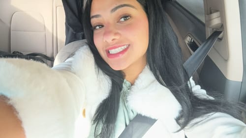 Customer photo review of Whitening Strips (16 - Day Treatment)