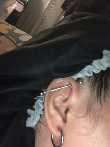 Customer photo review of Piercing Bump Treatment - Bump, Keloid & Scar Relief Oil