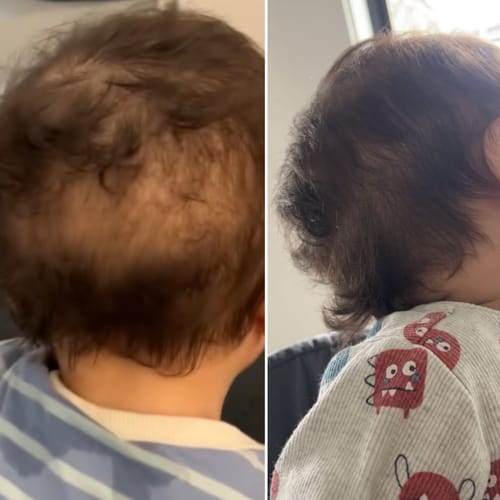 Customer photo review of Kids Hair Growth Oil