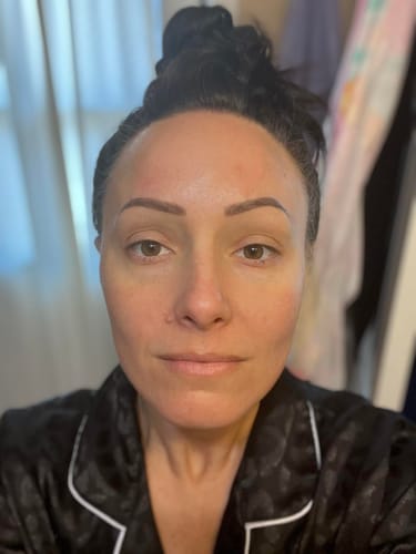 Customer photo review of Bio Kollagen Maske
