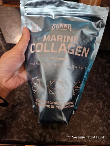 Customer photo review of Marine Collagen
