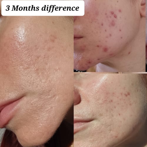 Customer photo review of Skin & Gut Maintain™