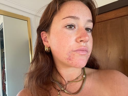 Customer photo review of Forever Bright Skin Set
