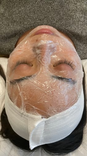 Customer photo review of The Translucent Esthetic Wrap™