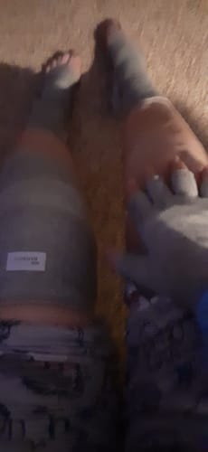 Customer photo review of Premium Onecompress™ Gloves