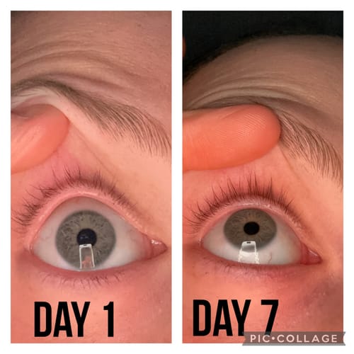 Customer photo review of LASH SERUM